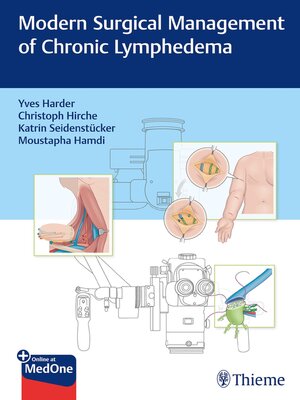 cover image of Modern Surgical Management of Chronic Lymphedema